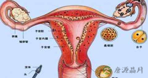 纵隔子宫要开刀吗 纵隔子宫要开刀吗