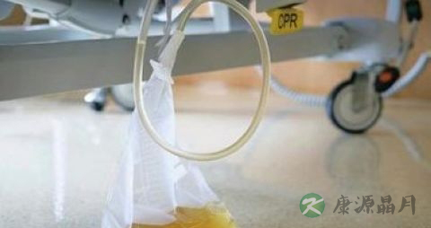 手术后导尿注意事项 手术后导尿注意事项