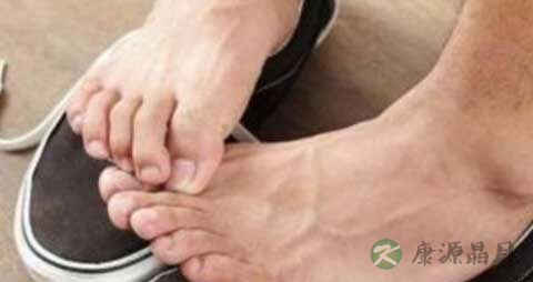 脚感染真菌不能吃什么 脚感染真菌不能吃什么