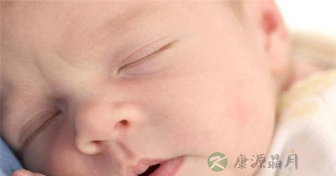 儿童肾综复发前兆 儿童肾综复发前兆