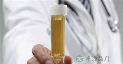 尿液有泡泡是肾有问题吗 尿液有泡泡是肾有问题吗
