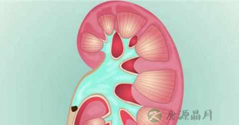 肾轻微积水怎么办 肾轻微积水怎么办