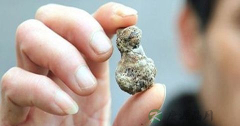 肾结石如何排石 肾结石如何排石