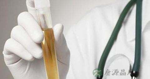 肾病一般做什么检查 肾病一般做什么检查