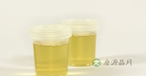 正常人肾多大 正常人肾多大
