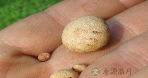 治疗肾结石需要多久 治疗肾结石需要多久