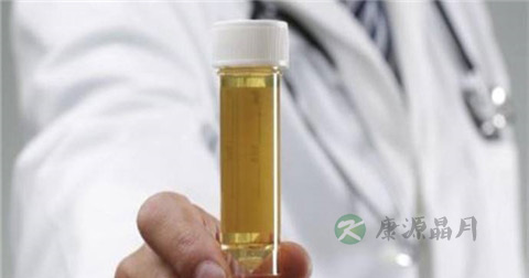 肾造影能查出肾结石吗 肾造影能查出肾结石吗