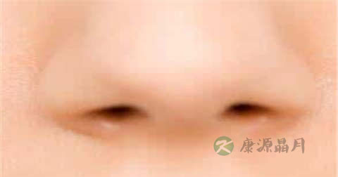 肺炎呼吸困难缓解方法 肺炎呼吸困难缓解方法