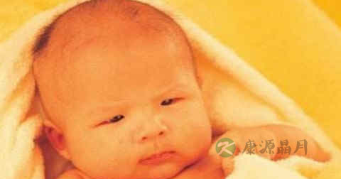 初生婴儿有黄疸要紧吗 初生婴儿有黄疸要紧吗