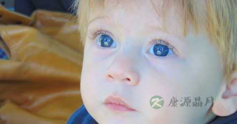 宝宝排便少怎么办 宝宝排便少怎么办