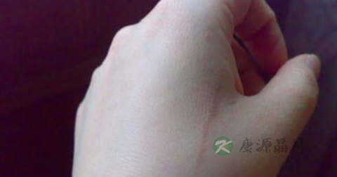 手术后疤痕治疗方法 手术后疤痕治疗方法