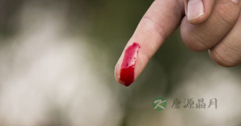 吃阿胶糕会口腔溃疡吗 吃阿胶糕会口腔溃疡吗