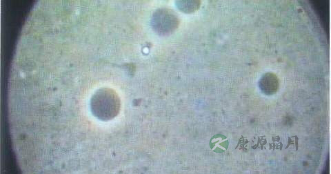 一般男人检查项目有几项 一般男人检查项目有几项