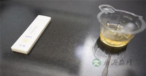 尿液能检查前列腺炎吗 尿液能检查前列腺炎吗