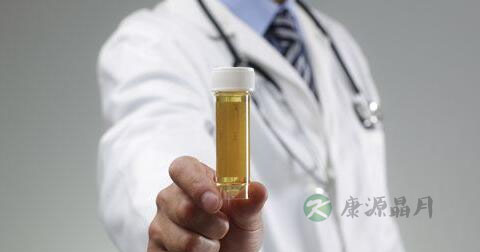 念珠菌尿道炎检查什么 念珠菌尿道炎检查什么