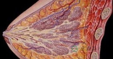 乳腺恶性肿瘤能摸的出来吗 乳腺恶性肿瘤能摸的出来吗