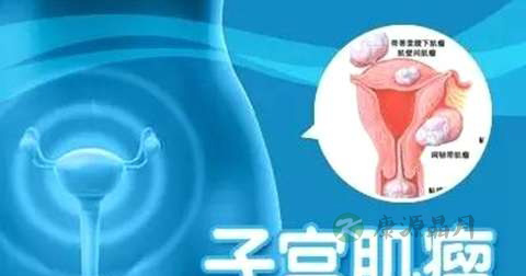子宫瘤的早期症状 子宫瘤的早期症状