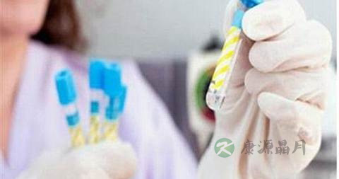 化验白带常规要多长时间 化验白带常规要多长时间