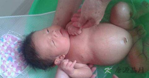 小婴儿正常肚子有多大 小婴儿正常肚子有多大