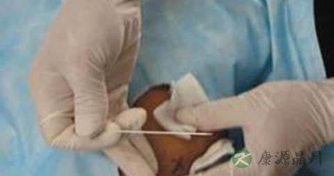 新生儿腰穿检查什么病 新生儿腰穿检查什么病
