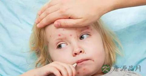 儿童起疹子要挂什么科 儿童起疹子要挂什么科