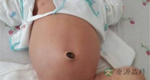 小婴儿正常肚子有多大 小婴儿正常肚子有多大