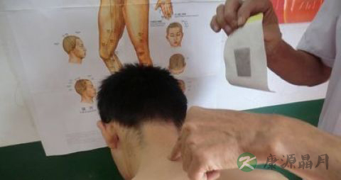 颈椎病吃什么食物好 颈椎病吃什么食物好