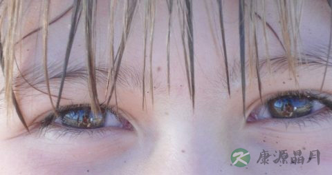 如何保护眼睛视力上升 如何保护眼睛视力上升