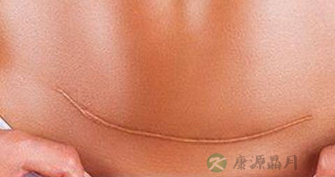 刨妇产多久可以减肥 刨妇产多久可以减肥