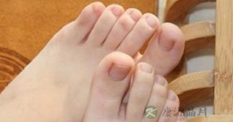 跳舞后脚母指关节痛怎回事 跳舞后脚母指关节痛怎回事
