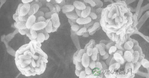 怎么得细菌性扁桃体炎 怎么得细菌性扁桃体炎