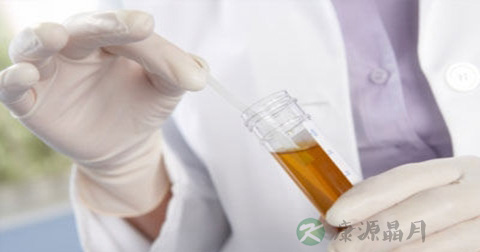 尿检ph值偏低注意事项 尿检ph值偏低注意事项
