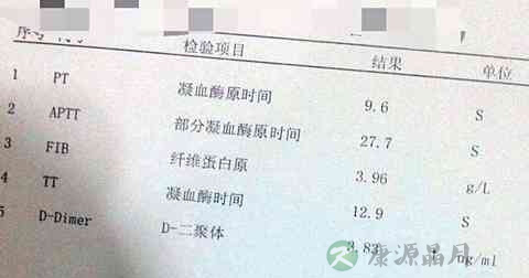 凝血功能化验单怎么看 凝血功能化验单怎么看