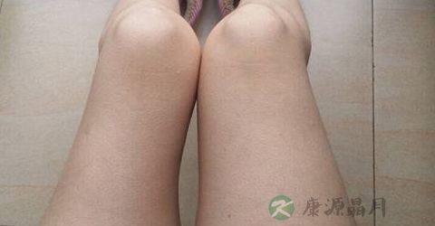 腿萎缩能恢复正常吗 腿萎缩能恢复正常吗