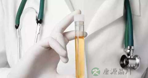 尿检PH值是9正常吗 尿检PH值是9正常吗