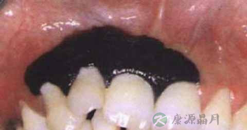 口腔颌面部损伤特点 口腔颌面部损伤特点