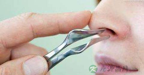咽炎能引起口干吗 咽炎能引起口干吗