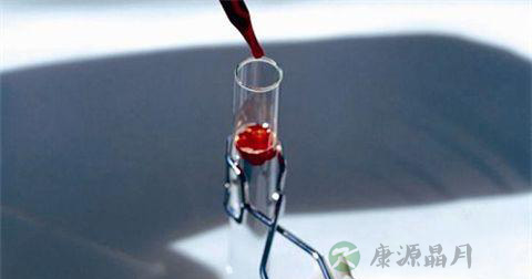 血红蛋白的正常值 血红蛋白的正常值