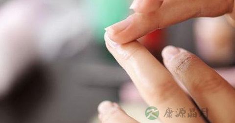 手指甲发白的原因 手指甲发白的原因