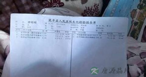 促甲状腺激素临床意义 促甲状腺激素临床意义