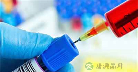 什么是黄体功能不足 什么是黄体功能不足