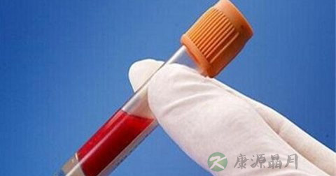 血液检查的正常值