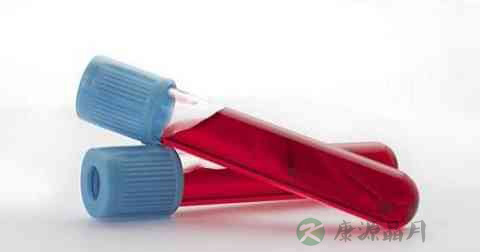 凝血功能化验单怎么看 凝血功能化验单怎么看