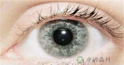 甲亢突眼能恢复正常吗 甲亢突眼能恢复正常吗