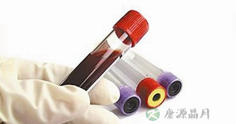 肌红蛋白的正常值