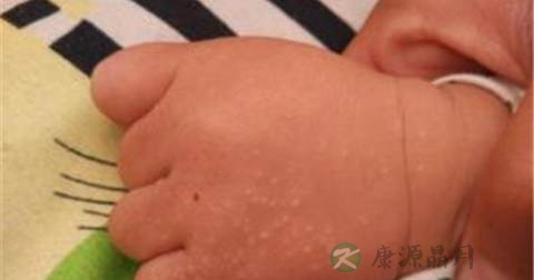 手背上起小疙瘩的原因 手背上起小疙瘩的原因
