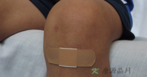 经常患扁平疣吃什么药预防 经常患扁平疣吃什么药预防