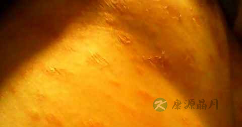 皮炎平能擦玫瑰糠疹吗 皮炎平能擦玫瑰糠疹吗