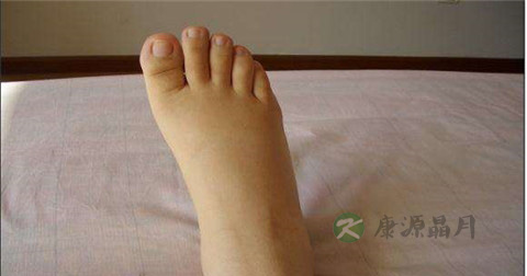 慢性肾炎吃什么药最好 慢性肾炎吃什么药最好