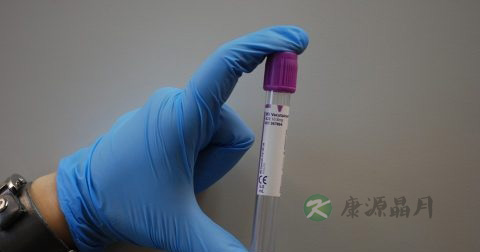 黄热病疫苗注意事项 黄热病疫苗注意事项
